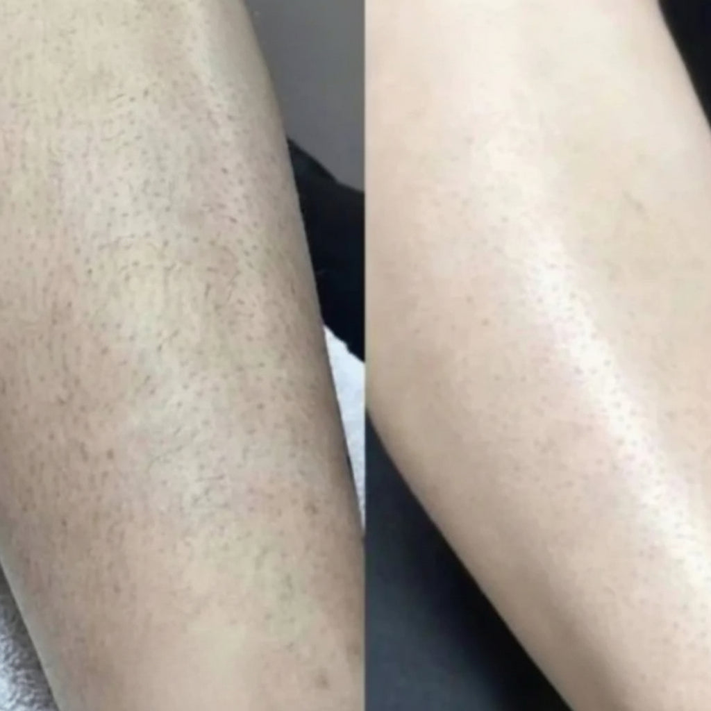 Women's Waterproof Electric Razor | Sensitive Skin and Bikini Line